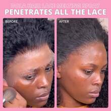 4pcs /Set Including: 2fl.Oz/ 100ml Lace Melting And Holding Spray Glue-Less Liquid Adhesive, Suitable For Closure Hair Extension Extra Hold Natural Forming Hold Protect Edge,Lace Glue And Remover For Front Lace Wig Hair Glue Wig Glue Lace Wig Glue Lace Gl