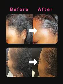 Non-Greasy, Edge Control, Strong Hold, No White Residue, Suitable For Women