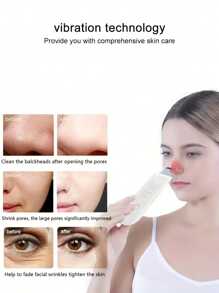 Electric Ultrasonic Blackhead Remover, Blackhead Vacuum Suction Beauty Device, Skin Pore Cleaner, Painless Blackhead & Pimple Cleaning, For Home Use