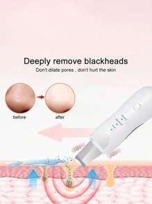 Electric Ultrasonic Blackhead Remover, Blackhead Vacuum Suction Beauty Device, Skin Pore Cleaner, Painless Blackhead & Pimple Cleaning, For Home Use