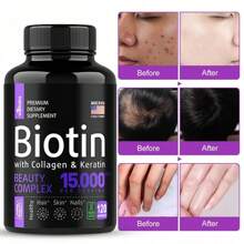 Biotin Capsules - Support Hair Growth, With Vitamin B6 B2 D3, Easy To Absorb, 120 Capsules