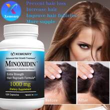 XEMENRY Minnoxidin - Extra Strength Hair Regrowth Formula,Prevent Hair Loss - 120pcs