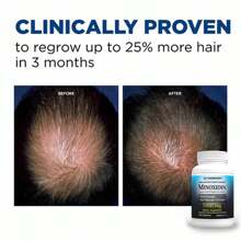 XEMENRY Minnoxidin - Extra Strength Hair Regrowth Formula,Prevent Hair Loss - 120pcs