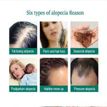 XEMENRY Minnoxidin - Extra Strength Hair Regrowth Formula,Prevent Hair Loss - 120pcs