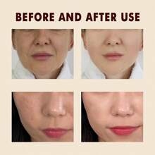 Rice Enzyme Bottle   Black Rice Enzyme Bottle; Soft Exfoliating Facial And Body Scrub For Dead Skin, Blackhead Suitable For All Skin Types