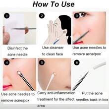 4-Piece Professional Blackhead Removal Set - Acne Removal Tools For Whitehead Acne Removal - Deep Cleansing And Skin Cleansing Tools For Acne Removal - Beauty Tools