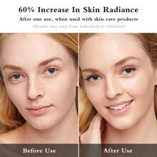 4-In-1 Microcurrent Face Massager Facial Glow Booster Pro