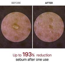 Dr.Melaxin [Dr.Melaxin Official] Peel Shot Glow Rice Ampoule Duo - Serums For Brightening, Exfoliating, And Moisturizing - Suitable For All Skin Types