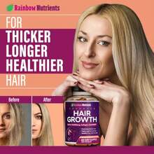 Hair Growth Vitamins For Women – Biotin 10,000mcg, Collagen, OptiMSM®, GoMCT®, Saw Palmetto – Supports Stronger Hair, Skin & Nails – 60-Day Supply