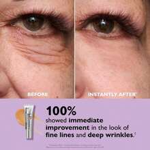 Peter Roth Instant FirmX Easy Wear Temporary Eye Tightener