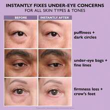 Peter Roth Instant FirmX Easy Wear Temporary Eye Tightener